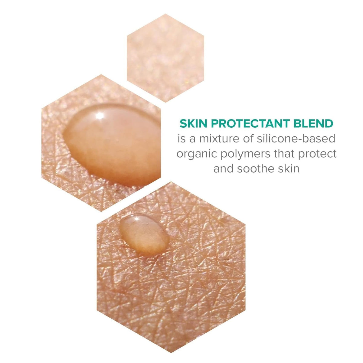 McKesson Thera® Calazinc Body Shield