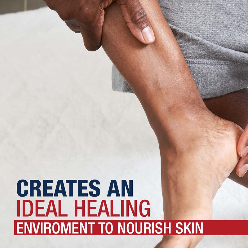 Aquaphor® Original Moisturizer Ointment