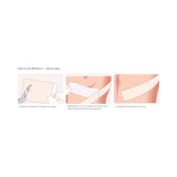 Mepiform® Self Adherent Silicone Dressings Dressing 