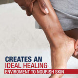 Aquaphor® Original Moisturizer Ointment 