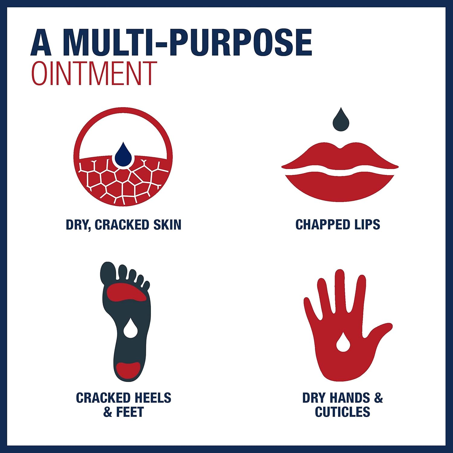 Aquaphor® Advanced Therapy Hand and Body Moisturizer 0.35 oz. Tube Pack of 2