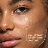 Neutrogena® Oil Free Acne Wash with Salicylic Acid