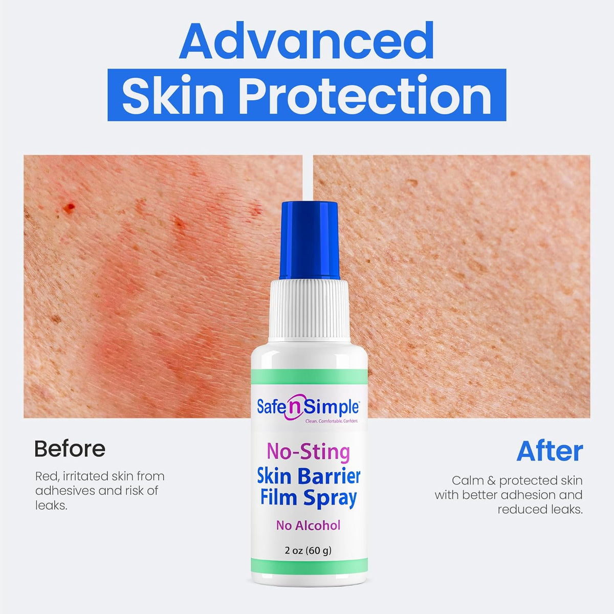 Safe n Simple™ Skin Barrier Film Spray Bottle 1 Each 