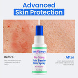 Safe n Simple™ Skin Barrier Film Spray Bottle 1 Each 
