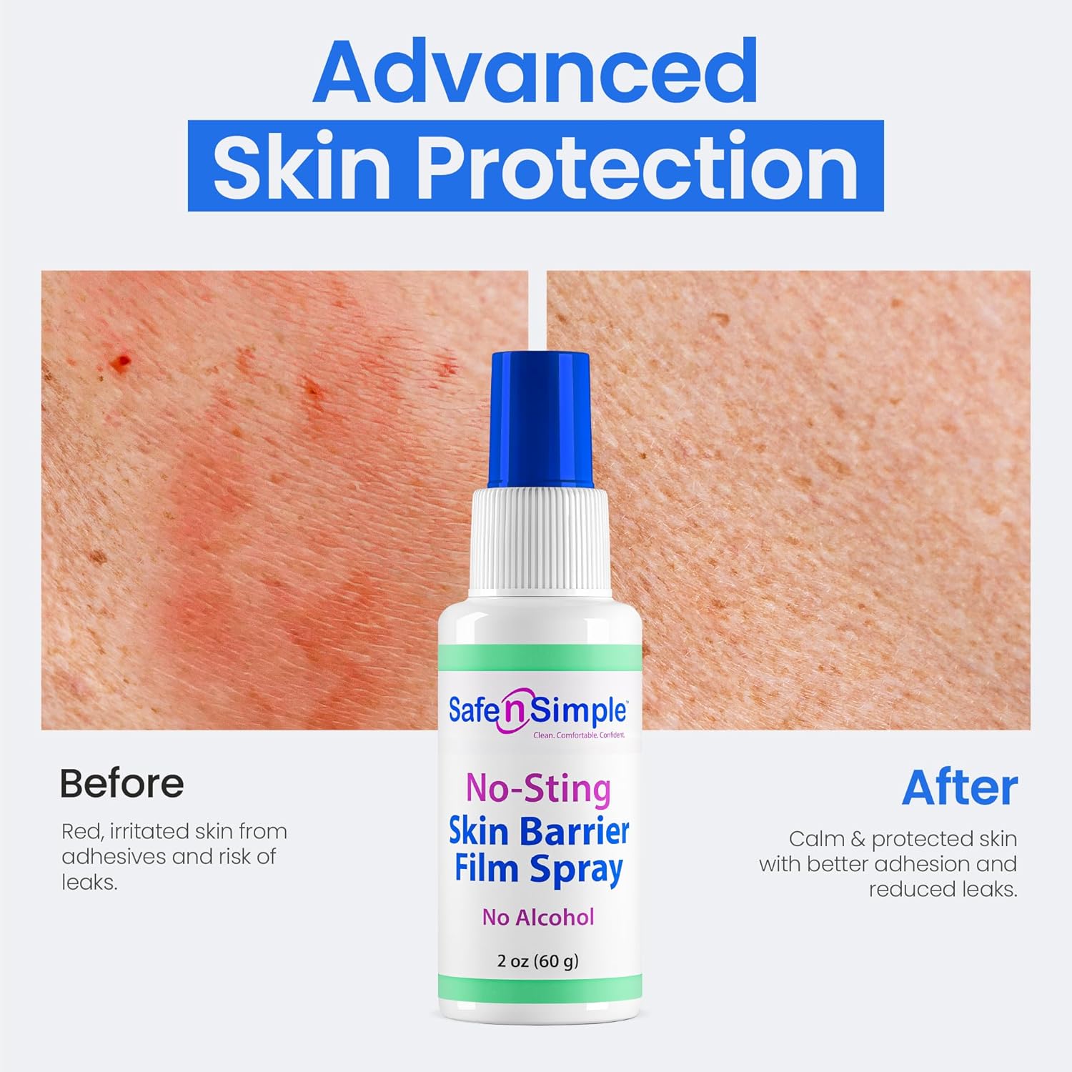 Safe n Simple™ Skin Barrier Film Spray Bottle 1 Each 