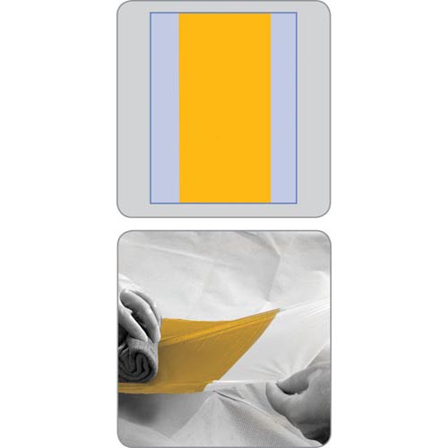 Acti-Gard Antimicrobial Incise Surgical Drape: , Case of 40 (DYNJSD6640)