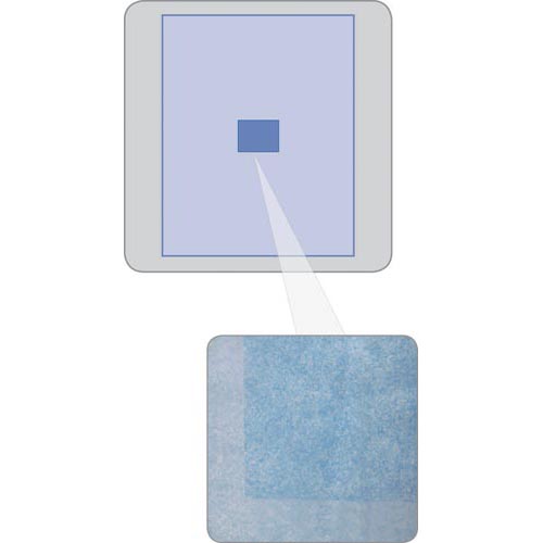 Invisishield Ophthalmic Incise Surgical Drape: , Case of 40 (DYNJSD1060)